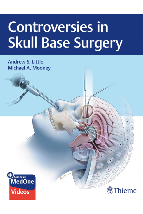 Controversies in Skull Base Surgery