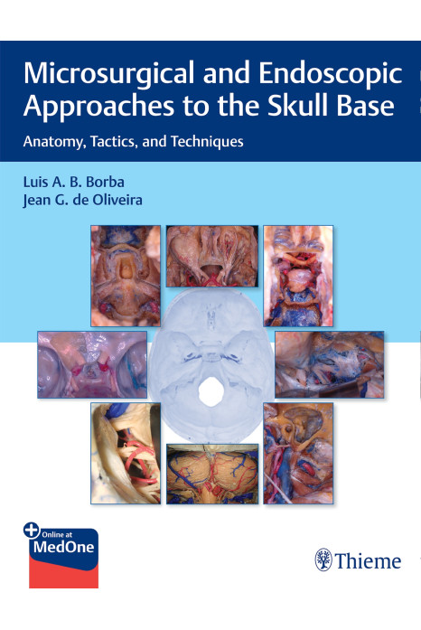 Microsurgical and Endoscopic Approaches to the Skull Base