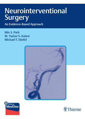 Neurointerventional Surgery