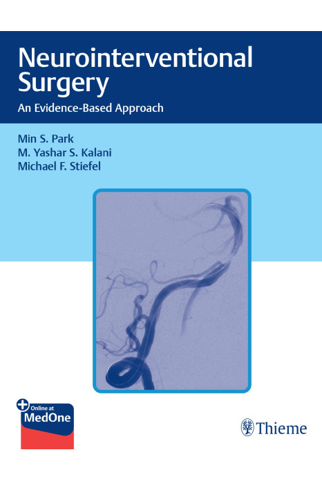 Neurointerventional Surgery