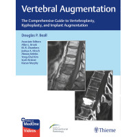 Vertebral Augmentation