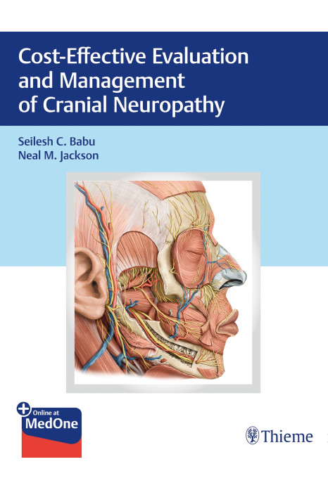 Cost-Effective Evaluation and Management of Cranial Neuropathy