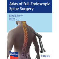 Atlas of Full-Endoscopic Spine Surgery