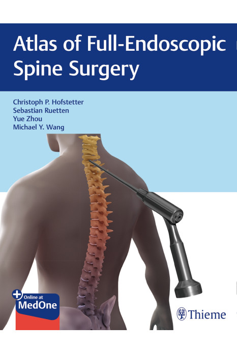 Atlas of Full-Endoscopic Spine Surgery