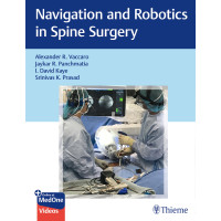 Navigation and Robotics in Spine Surgery