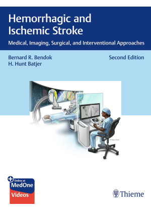 Hemorrhagic and Ischemic Stroke