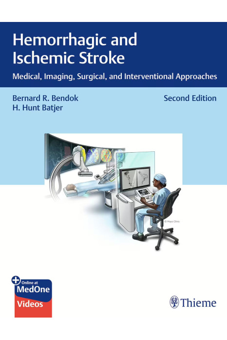 Hemorrhagic and Ischemic Stroke