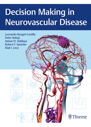 Decision Making in Neurovascular Disease