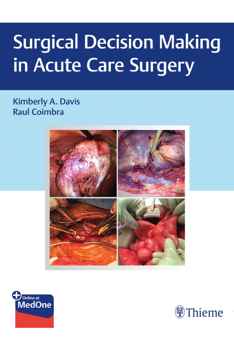 Surgical Decision Making in Acute Care Surgery