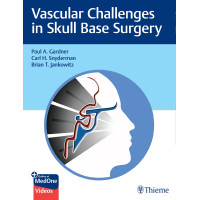 Vascular Challenges in Skull Base Surgery