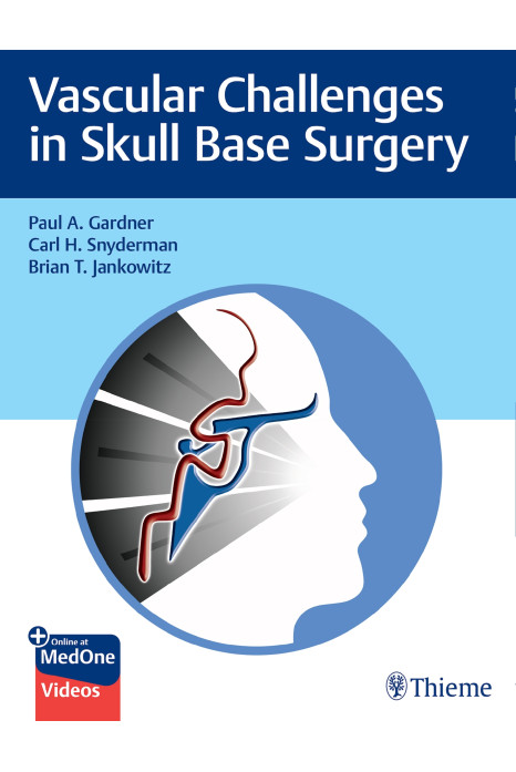 Vascular Challenges in Skull Base Surgery