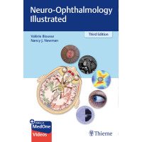 Neuro-Ophthalmology Illustrated