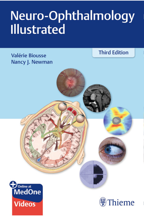 Neuro-Ophthalmology Illustrated