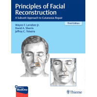 Principles of Facial Reconstruction