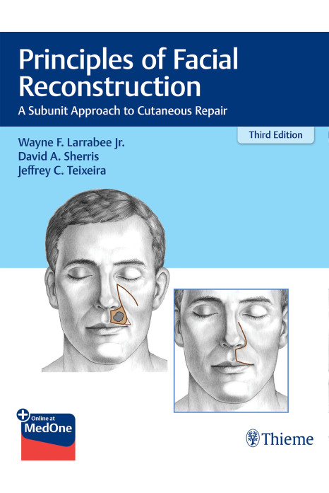 Principles of Facial Reconstruction