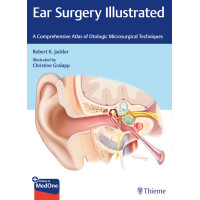 Ear Surgery Illustrated