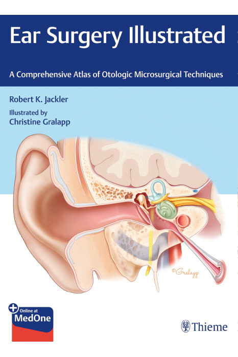 Ear Surgery Illustrated