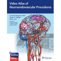 Video Atlas of Neuroendovascular Procedures