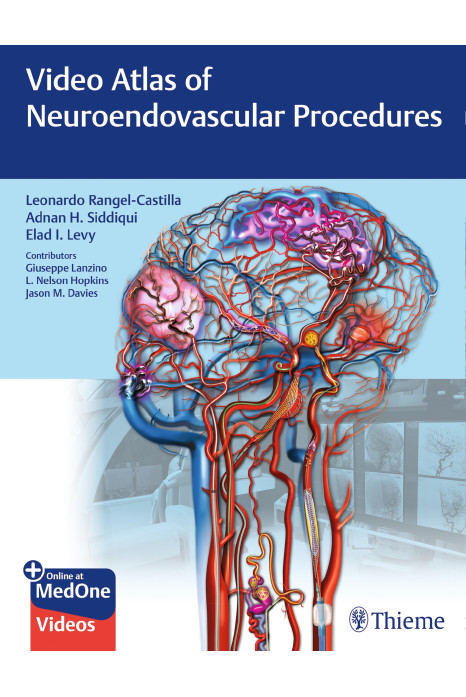 Video Atlas of Neuroendovascular Procedures