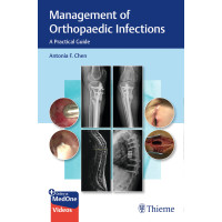 Management of Orthopaedic Infections