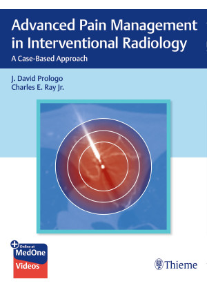 Advanced Pain Management in Interventional Radiology