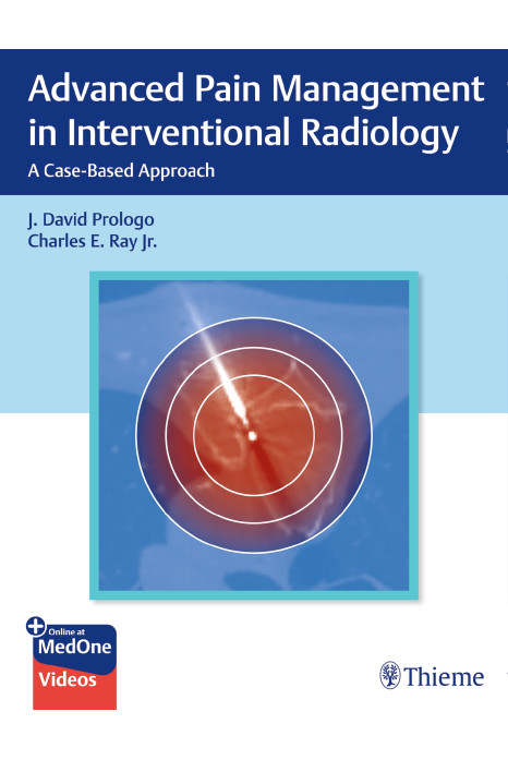 Advanced Pain Management in Interventional Radiology