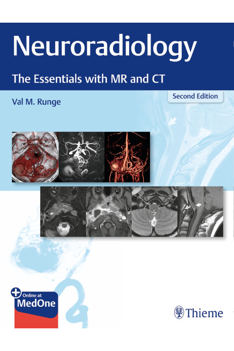 Neuroradiology