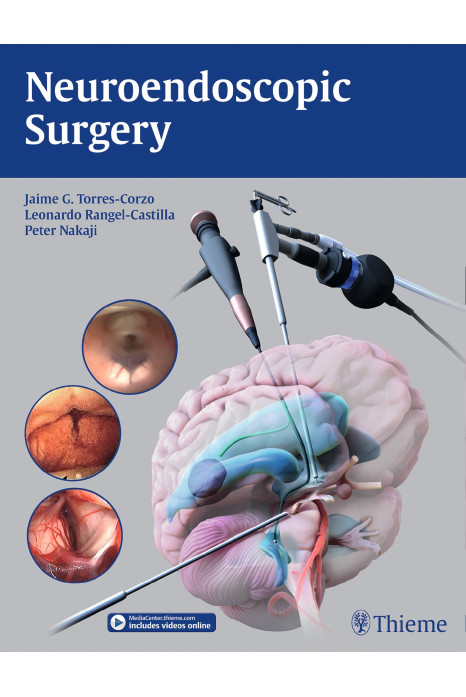 Neuroendoscopic Surgery