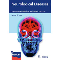 Neurological Diseases