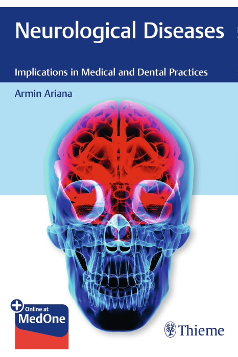 Neurological Diseases