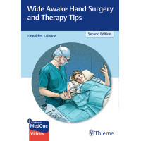 Wide Awake Hand Surgery and Therapy Tips