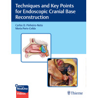 Techniques and Key Points for Endoscopic Cranial Base Reconstruction