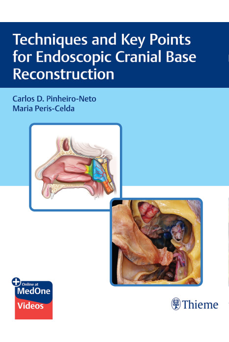 Techniques and Key Points for Endoscopic Cranial Base Reconstruction