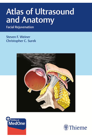 Atlas of Ultrasound and Anatomy