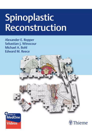 Spinoplastic Reconstruction