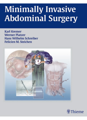 Minimally Invasive Abdominal Surgery