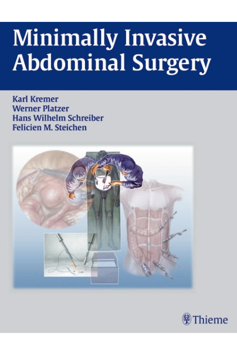 Minimally Invasive Abdominal Surgery