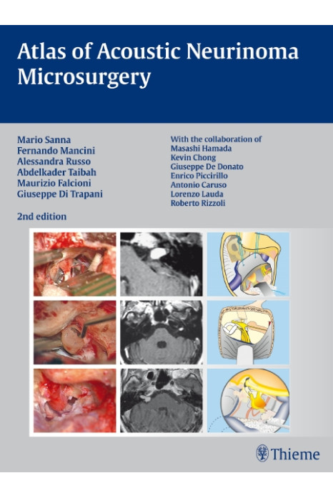 Atlas of Acoustic Neurinoma Microsurgery