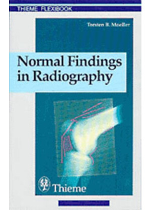 Normal Findings in Radiography