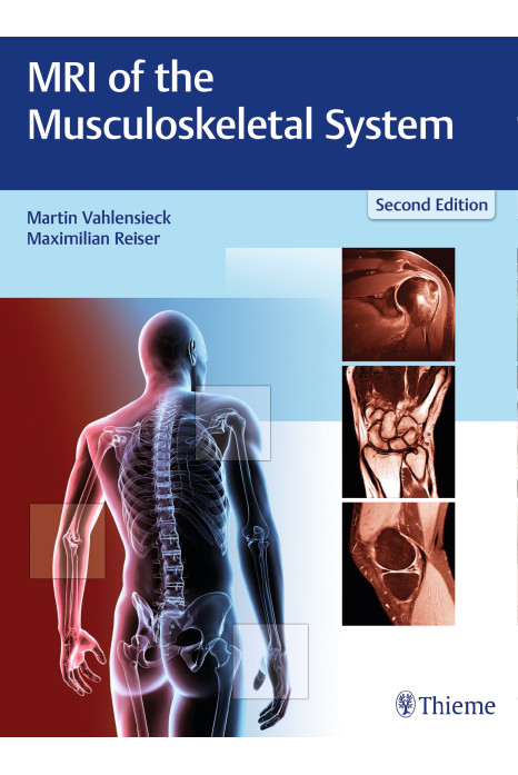 MRI of the Musculoskeletal System