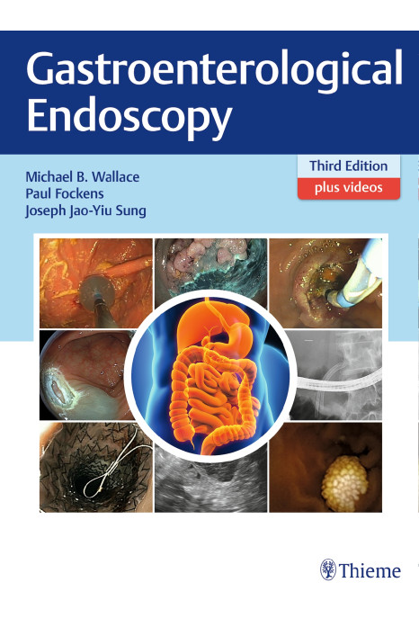 Gastroenterological Endoscopy