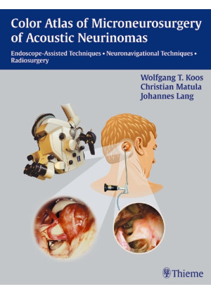 Color Atlas of Microsurgery of Acoustic Neurinomas