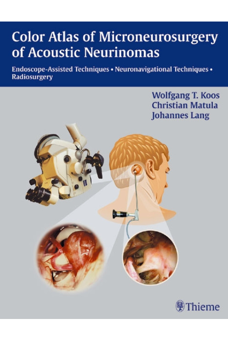 Color Atlas of Microsurgery of Acoustic Neurinomas