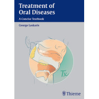 Treatment of Oral Diseases