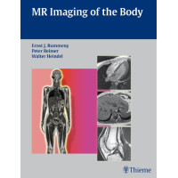 MR Imaging of the Body