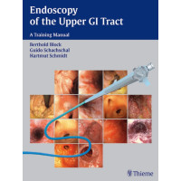 Endoscopy of the Upper GI Tract