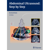 Abdominal Ultrasound