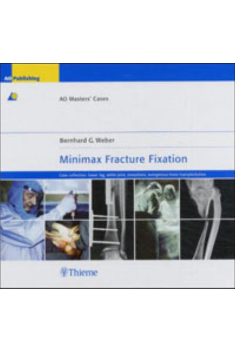 Minimax Fracture Fixation