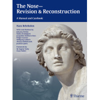 The Nose - Revision and Reconstruction