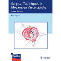 Surgical Techniques in Moyamoya Vasculopathy